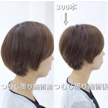 F52681DB-DAC5-48F1-AB96-6F3EBBC87232