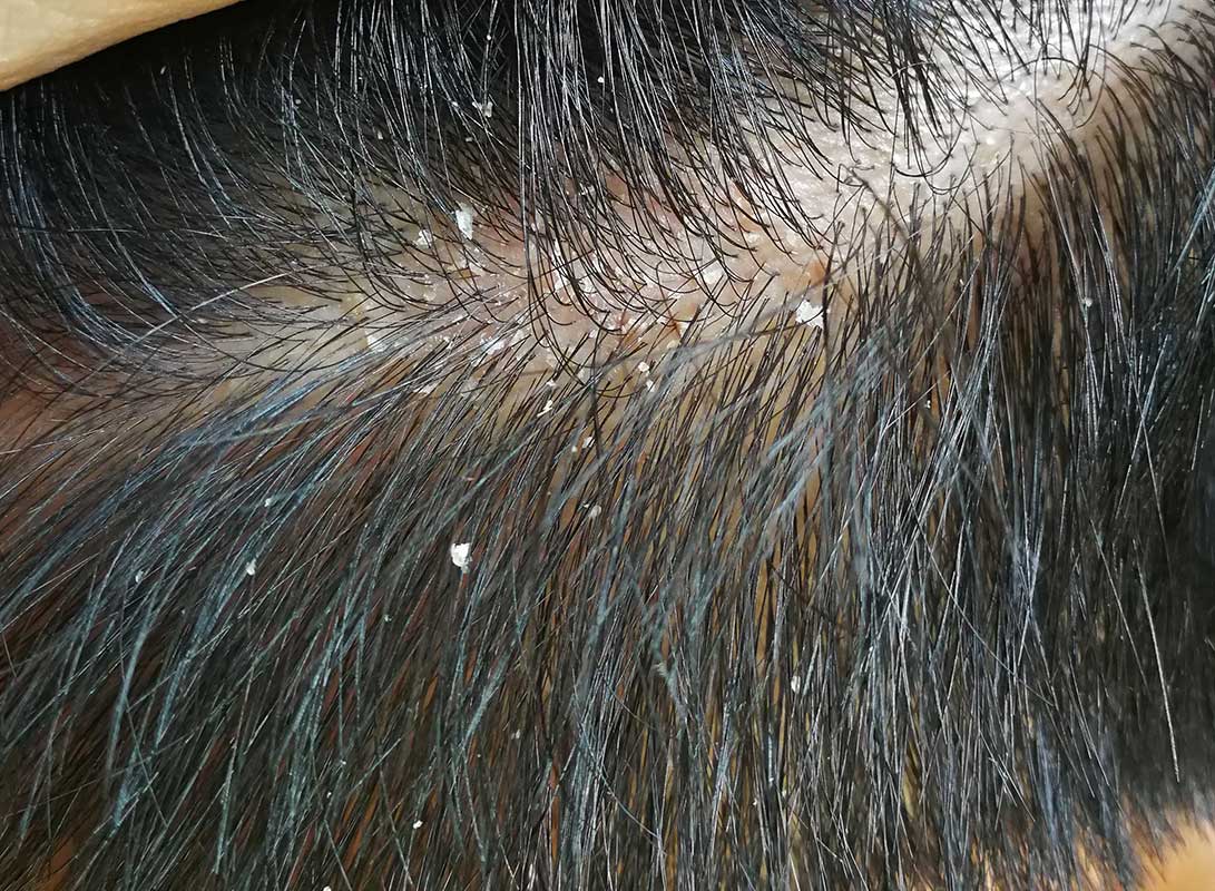 BB35DF02-C604-414D-AA18-C1D1EAD4A7BA