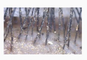 AA1738CD-A387-4AFE-ACB8-EBB38837348B